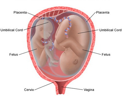 Risk of Multiple Birth Pregnancy